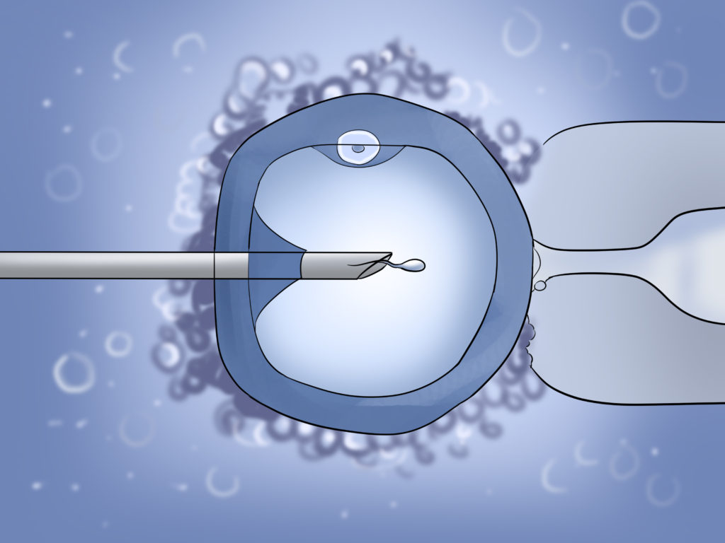 Intra Cytoplasmic Sperm Injection – Jilla IVF Center
